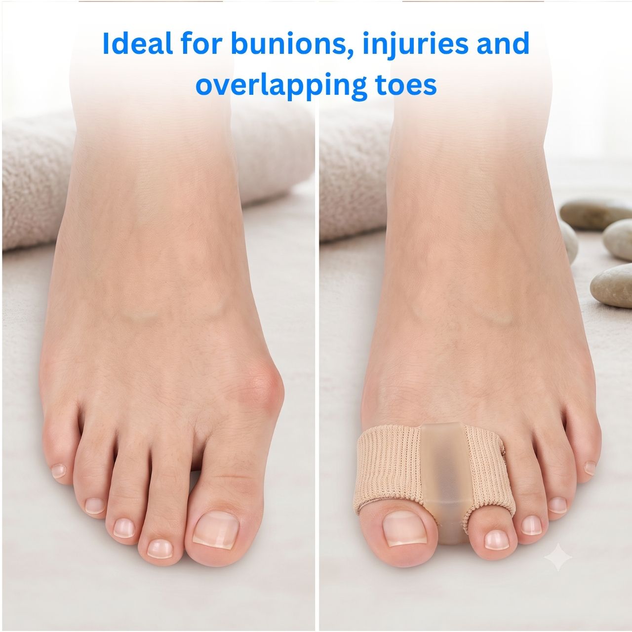 Toe Corrector, AlignToe - Image 3
