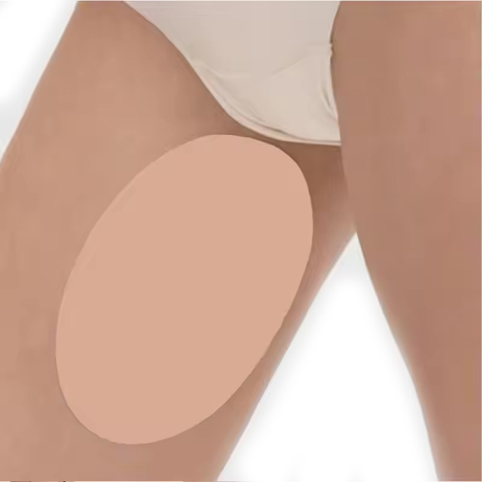 AntiChafing, self-adhesive protection to prevent chafing between the thighs (2 pieces) - Image 3