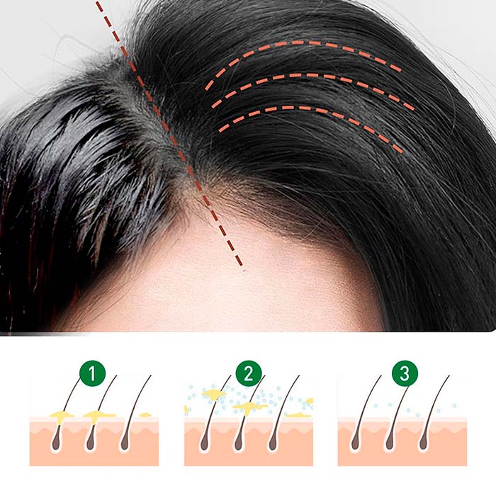 The hair spray helps prevent dry ends and scalp irritation.