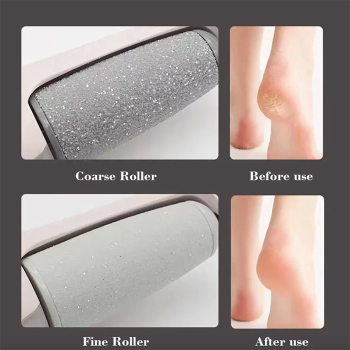 Heely, the electric roller for removing hard skin on heels - Image 4