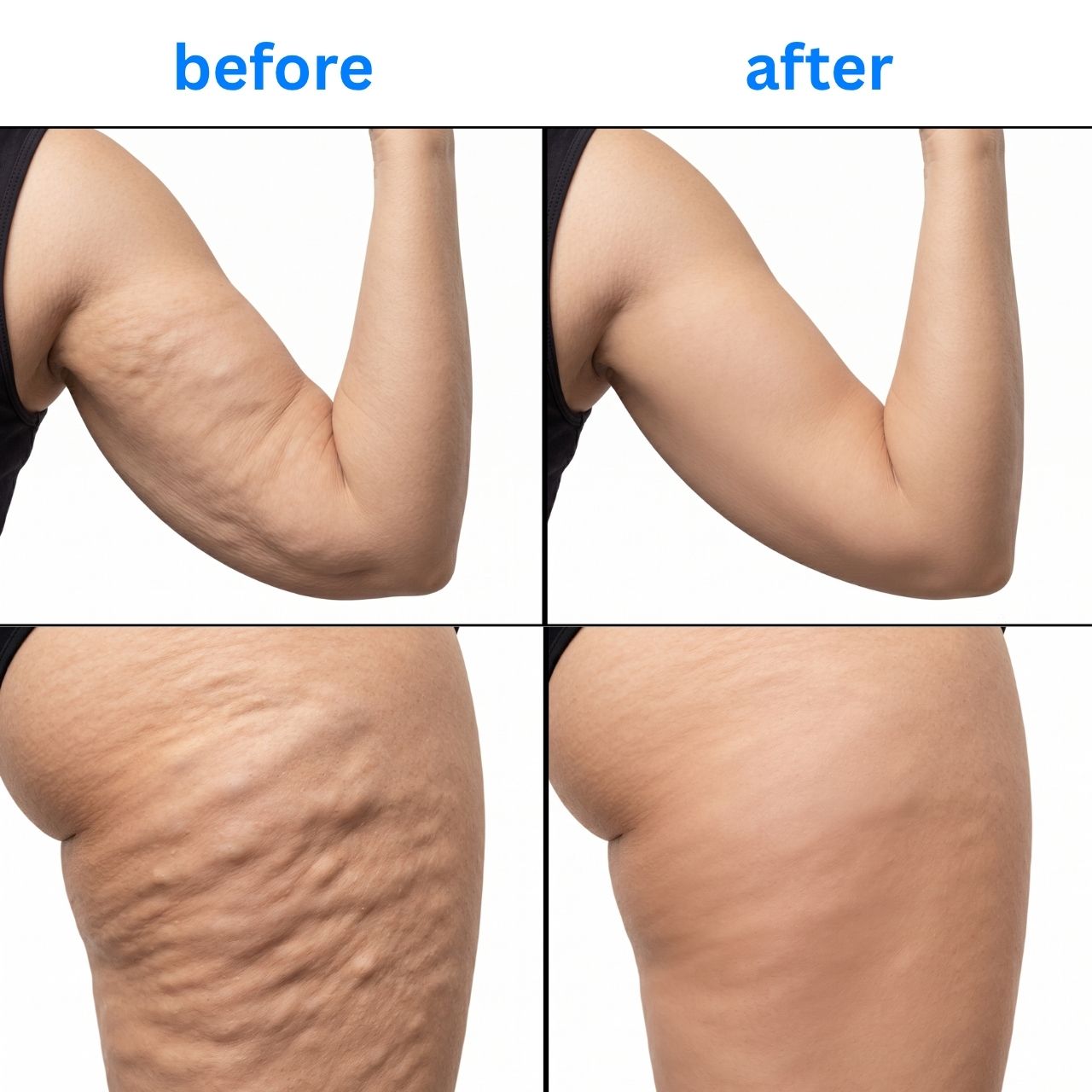 For body massage and cellulite reduction