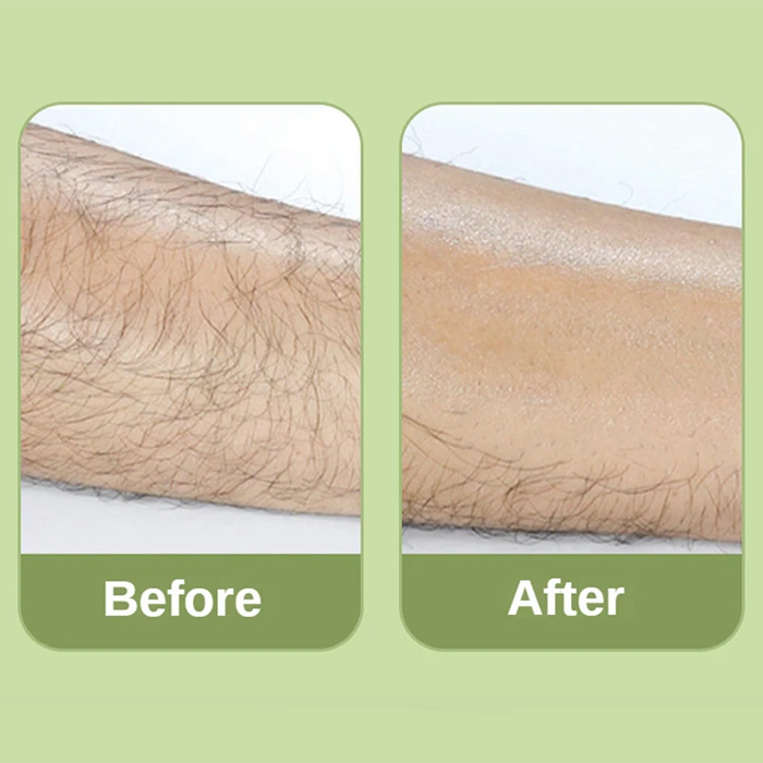 SoftSkin, a crystal hair remover that reduces hair growth and slows hair growth - Image 5