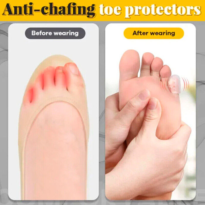 ToeProtector, silicone toe protector (10 pieces) - Image 5